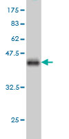 WB - UCHL3 Antibody (monoclonal) (M01) AT4456a